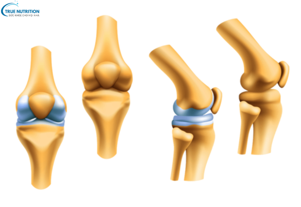 Phương Pháp Nắn Xương Chỉnh Hình: Cách Điều Trị Để Phục Hồi Sức Khỏe