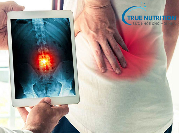 Biến chứng thoái hóa đốt sống thắt lưng