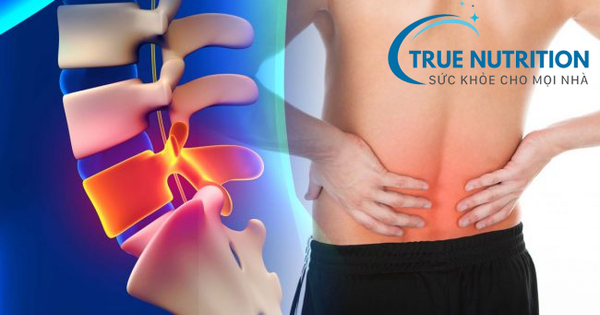 Biến chứng thoái hóa đốt sống thắt lưng