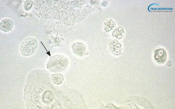 Soi Huyết Tương Trắng Cách Đọc Kết Quả & Ý Nghĩa Trong Phụ Khoa