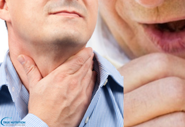 Triệu Chứng Bệnh Viêm Thực Quản: Đừng Bỏ Qua Những Cảnh Báo Sớm Này!