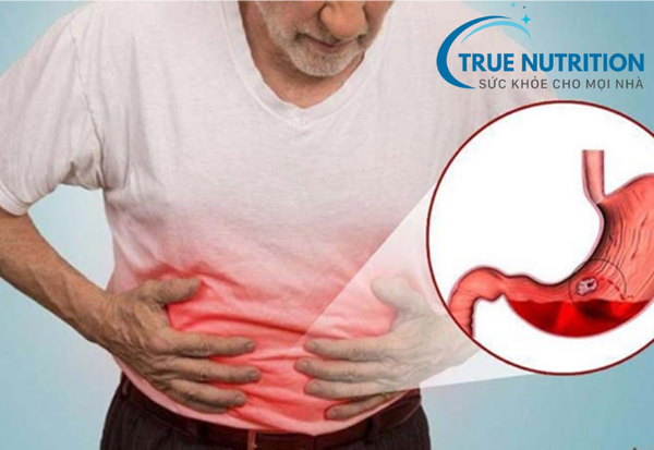 xuất huyết bao tử có nguy hiểm không