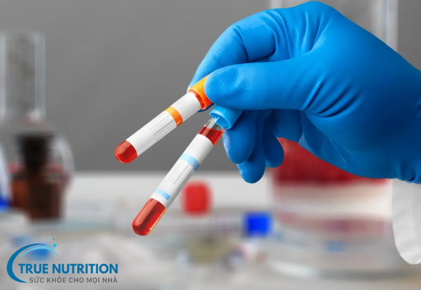 Thiếu Máu Là Gì? Nguyên Nhân và Phương Pháp Điều Trị Hiệu Quả