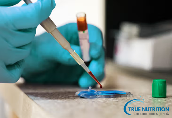 Thiếu Máu Là Gì? Nguyên Nhân và Phương Pháp Điều Trị Hiệu Quả