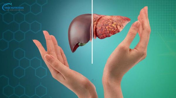 Bệnh Gan To Có Nguy Hiểm Không?