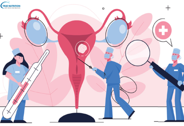 Dấu Hiệu Bệnh Ung Thư Buồng Trứng: Cách Nhận Biết Và Phòng Ngừa Sớm