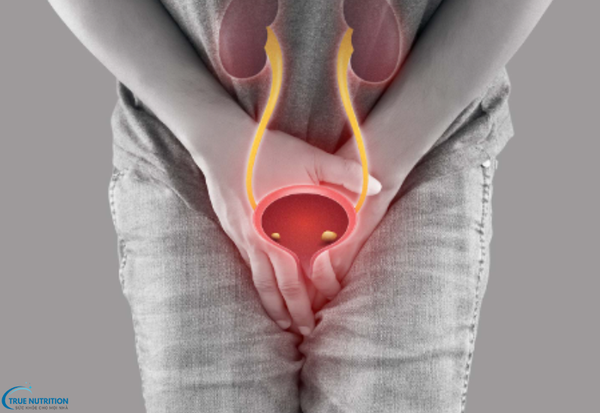 Viêm Niệu Đạo Không Do Lậu Là Gì? Nguyên Nhân Và Cách Điều Trị