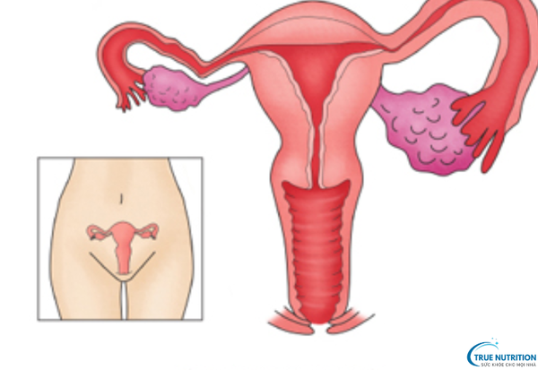 Viêm Niệu Đạo Không Do Lậu Là Gì? Nguyên Nhân Và Cách Điều Trị