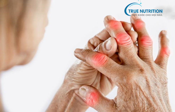 bệnh xương khớp