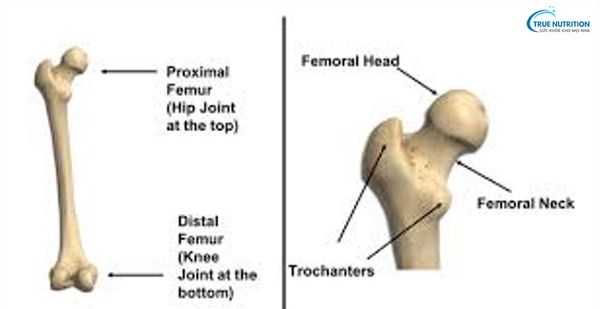 Chỏm Xương Đùi Là Gì? Hoại Tử Chỏm Xương Đùi Là Gì? Dấu Hiệu, Điều Trị, Bài Tập
