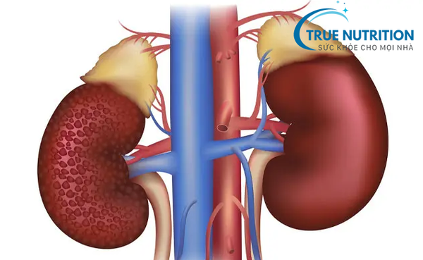 Điều Trị Biến Chứng Tiểu Đường