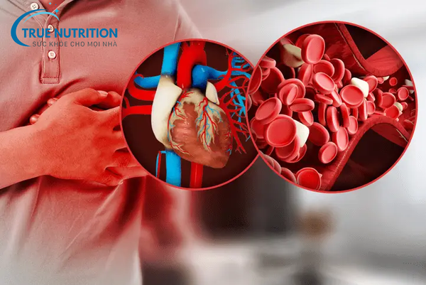 Điều Trị Biến Chứng Tiểu Đường