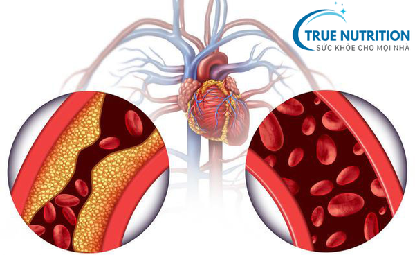 Điều Trị Biến Chứng Tiểu Đường