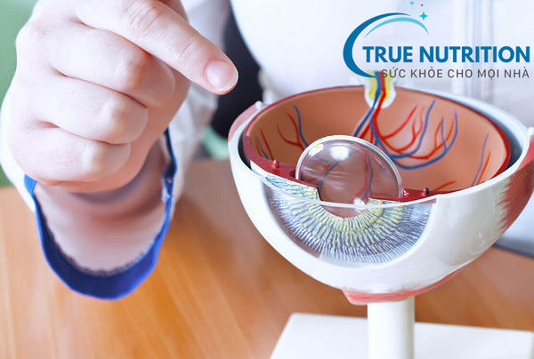 Điều Trị Mờ Mắt Do Tiểu Đường