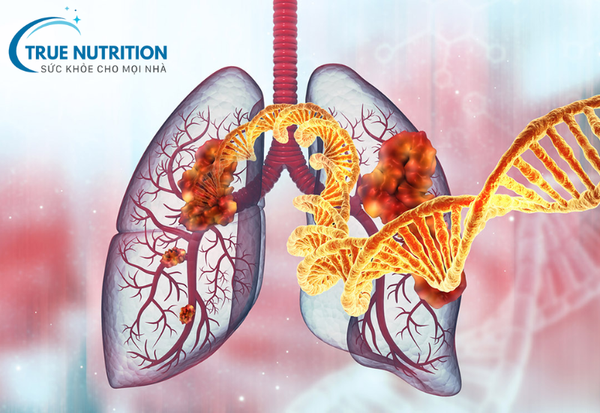 Ung thư phổi – Những điều cần biết và cách phòng tránh