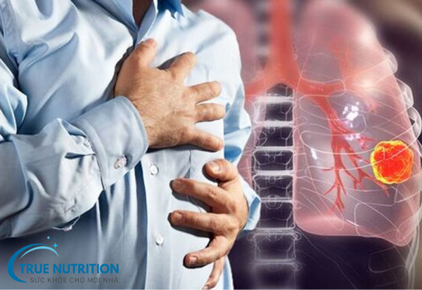 Ung thư phổi – Những điều cần biết và cách phòng tránh