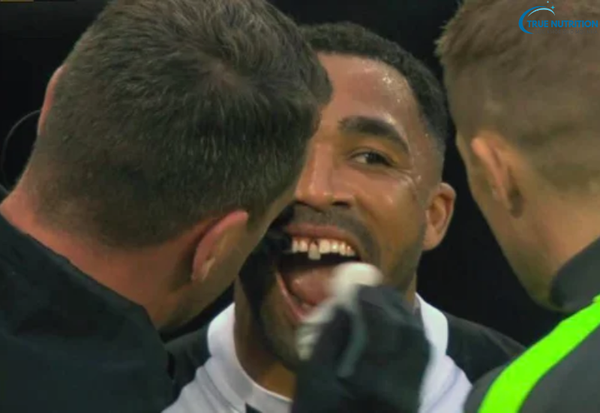 Gãy Răng Cửa Để Lâu Có Sao Không? Đừng Chủ Quan Trước Những Hậu Quả!