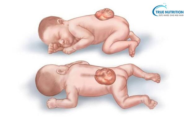 Xét Nghiệm Độ Mờ Da Gáy Giá Bao Nhiêu Tiền, Siêu Âm Tuần Bao Nhiêu?