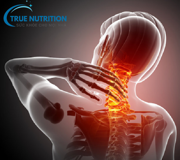 Chẩn đoán thoái hóa đốt sống cổ