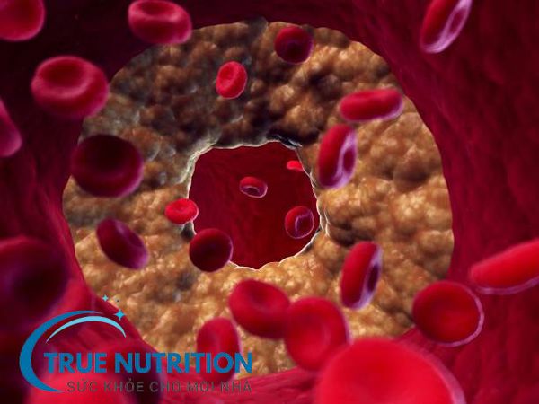 Chế độ ăn uống cho đối tượng có nguy cơ “mỡ máu” tăng cao?