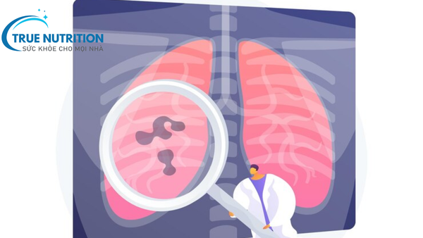 viêm phổi do whitmore