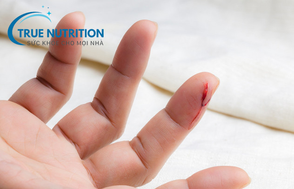 Người Tiểu Đường Có Bị Máu Khó Đông Không