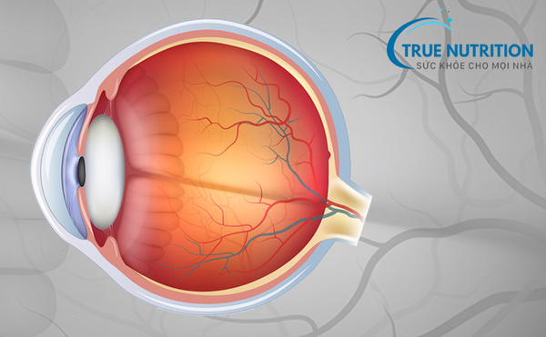 Triệu Chứng Bệnh Võng Mạc Tiểu Đường