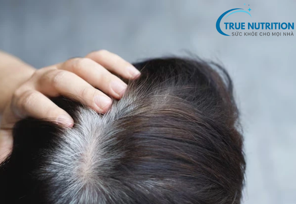 Tóc Bạc Sớm: Nguyên Nhân và Cách Khắc Phục Hiệu Quả