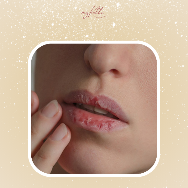 Dưỡng ẩm môi để môi không bị khô