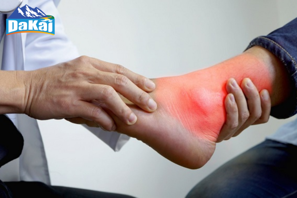 Bệnh gout là gì? Những điều cần biết về bệnh gout