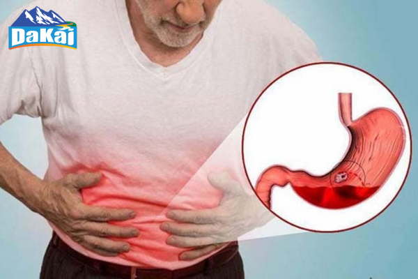 Đau dạ dày là đau ở đâu? Nguyên nhân và cách nhận biết bệnh đau dạ dày