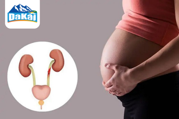 Tất tần tật về bệnh nhiễm khuẩn đường tiết niệu không nên bỏ qua