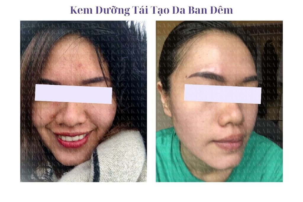 Phản hồi Kem Dưỡng Tái Tạo Da Ban Đêm KA GCG
