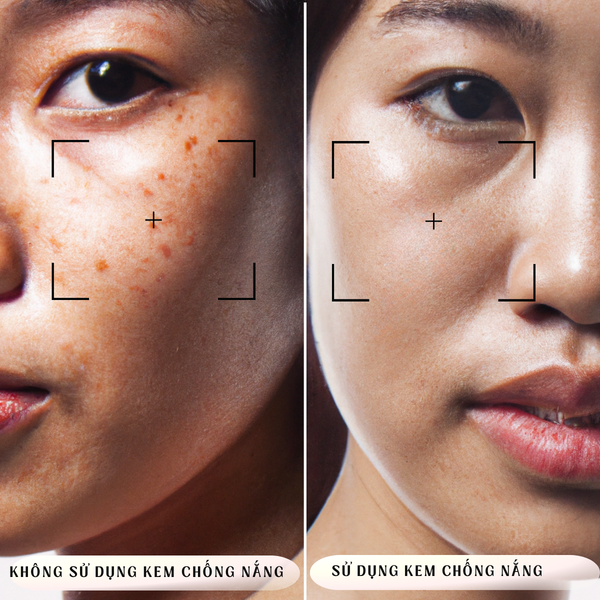 Tại Sao Phải Sử Dụng Kem Chống Nắng ?