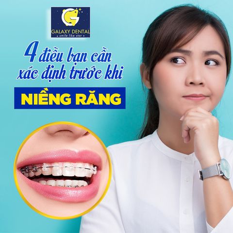 4 Điều bạn cần biết trước khi niềng răng