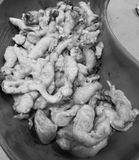 CA PHẪU THUẬT U XƠ TỬ CUNG PHỨC TẠP ĐƯỢC TS.BS BÙI CHÍ THƯƠNG CHIA SẺ