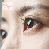 Lão Hóa Da Vùng Mắt: Bí Mật Từ Chuyên Gia & Giải Pháp Vàng