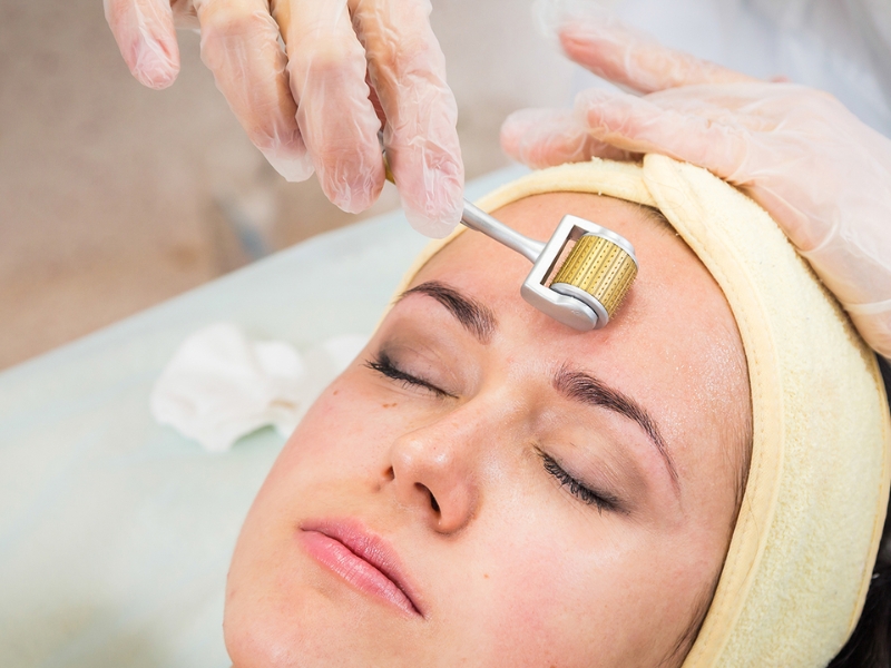 Các phương pháp điều trị sẹo lồi