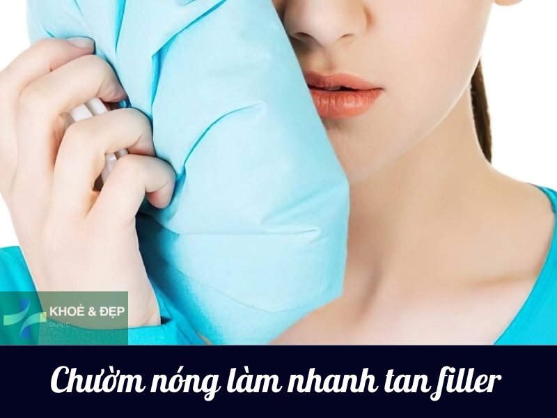 Chườm nóng làm filler nhanh tan
