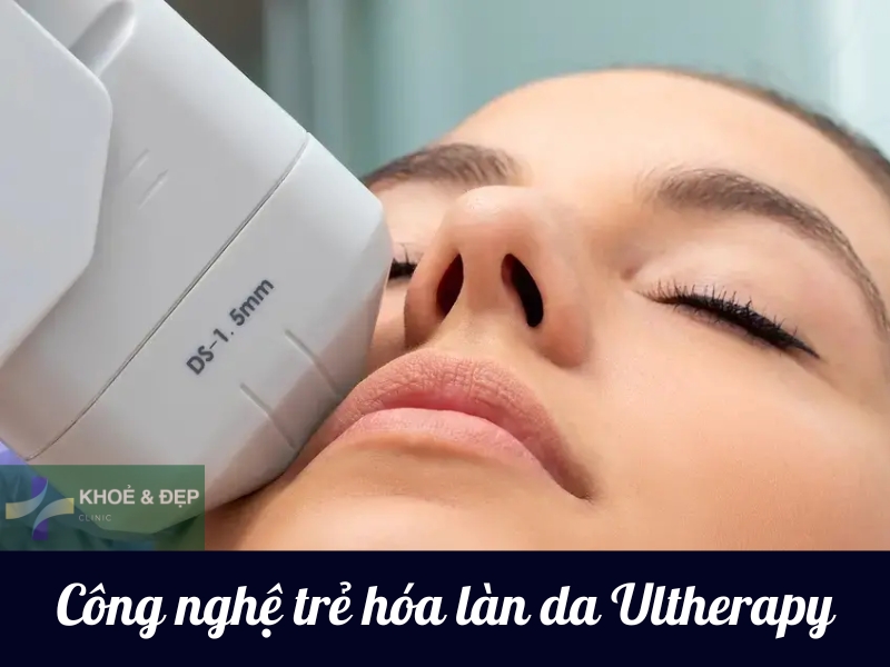 Công nghệ trẻ hóa làn da Ultherapy