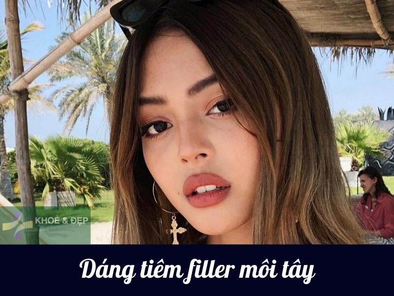 Tiêm môi dáng tây