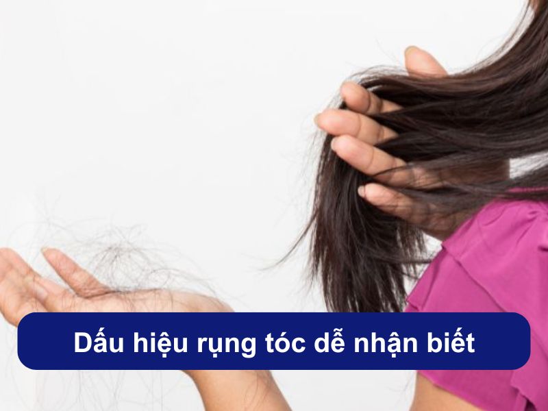 Dấu hiệu rụng tóc dễ nhận biết