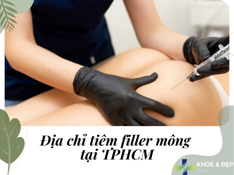 Những lưu ý khi tiêm filler mông