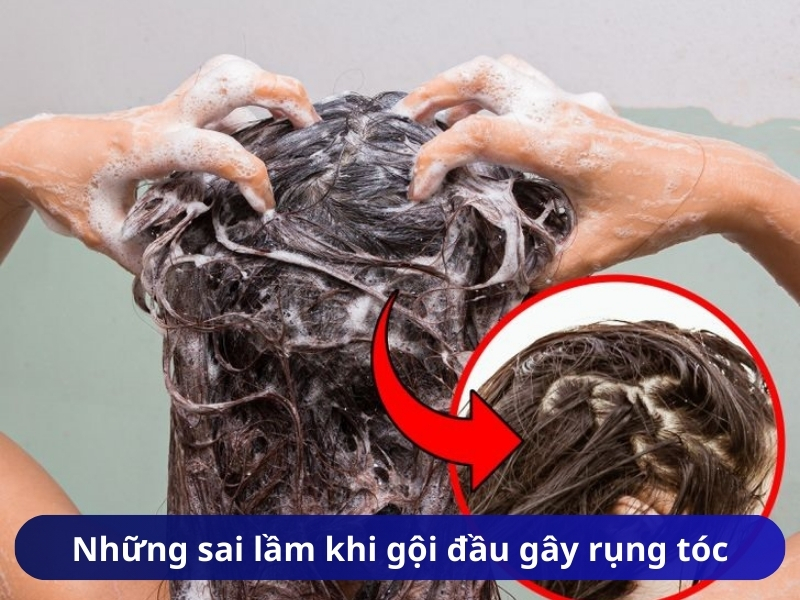 Những sai lầm khi gội đầu gây rụng tóc