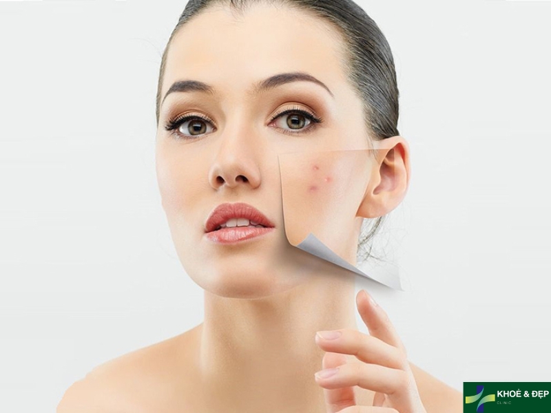 Lựa chọn kem dưỡng dựa theo nhu cầu cá nhân