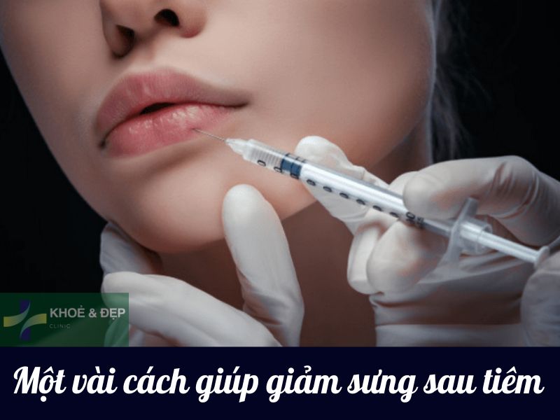 Những cách giúp giảm sưng sau khi tiêm filler