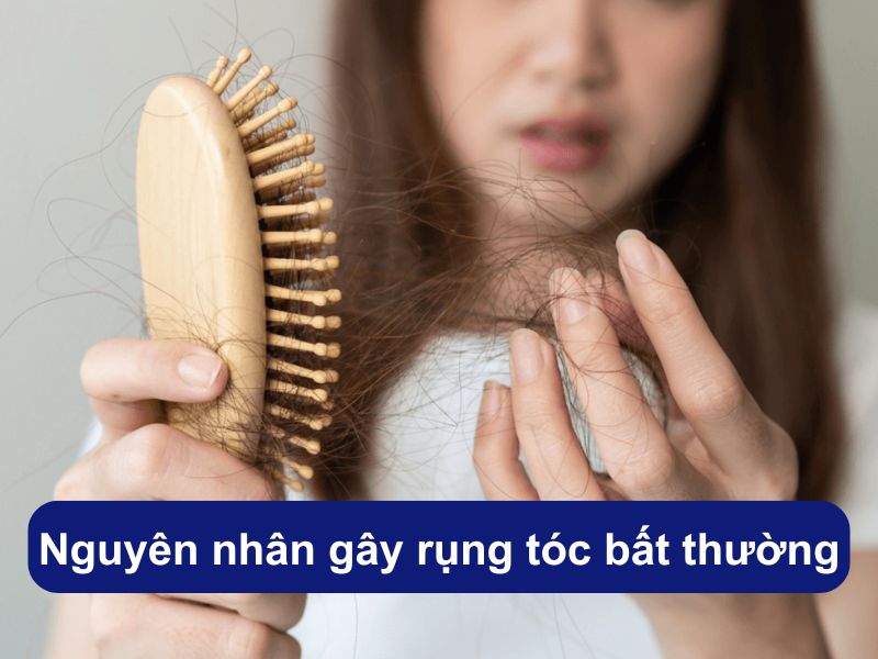 Nguyên nhân gây rụng tóc bất thường