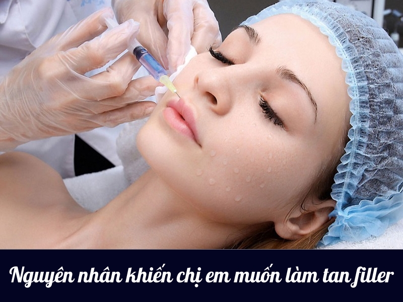 Lý do khiến chị em muốn làm tan filler