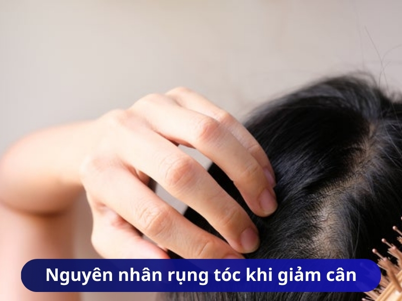 Nguyên nhân rụng tóc khi giảm cân