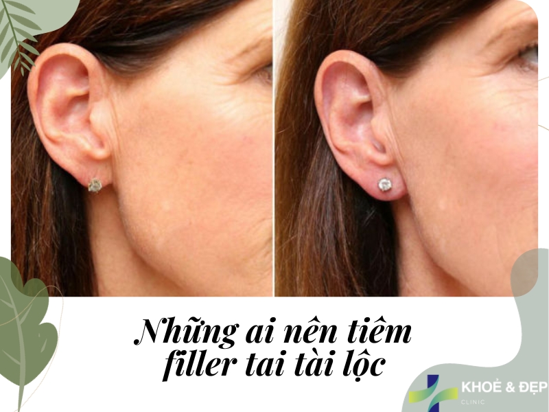 Những ai nên tiêm tai tài lộc?